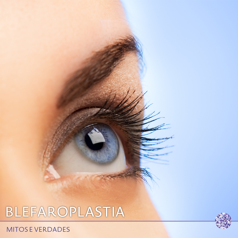Blefaroplastia: mitos e verdades!